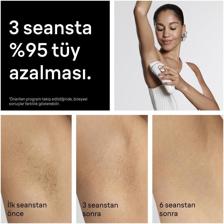 Braun IPL Silk·expert Pro 5, Evde Lazerle Tüy Alma, Çanta, Gillette Venus, 3 Başlık, PL5311 - 4
