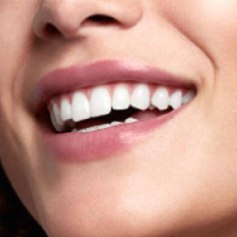 Oral-B Pro 3 3000 Sensitive Clean Şarj Edilebilir Diş Fırçası - 5